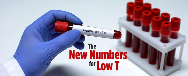Testosterone Levels: Challenging the 300 ng/dL Cutoff